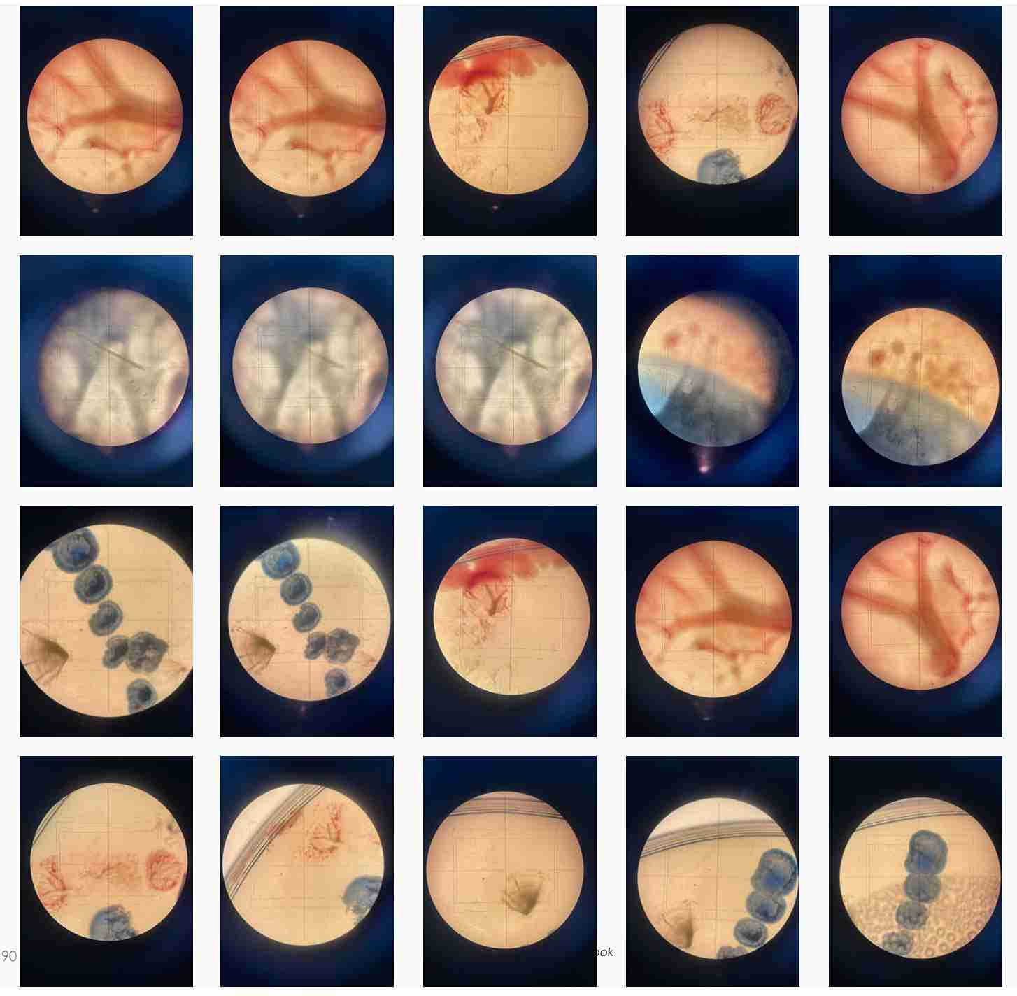 Microscopic observations